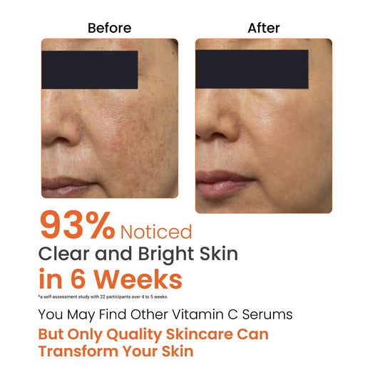 QC-glo 10% Vitamin C Face Serum - 30ml