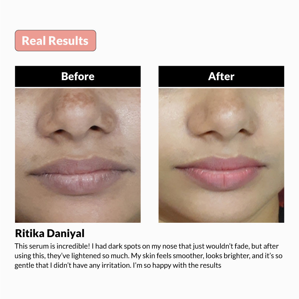 Mandine_serum_works_with_real_results