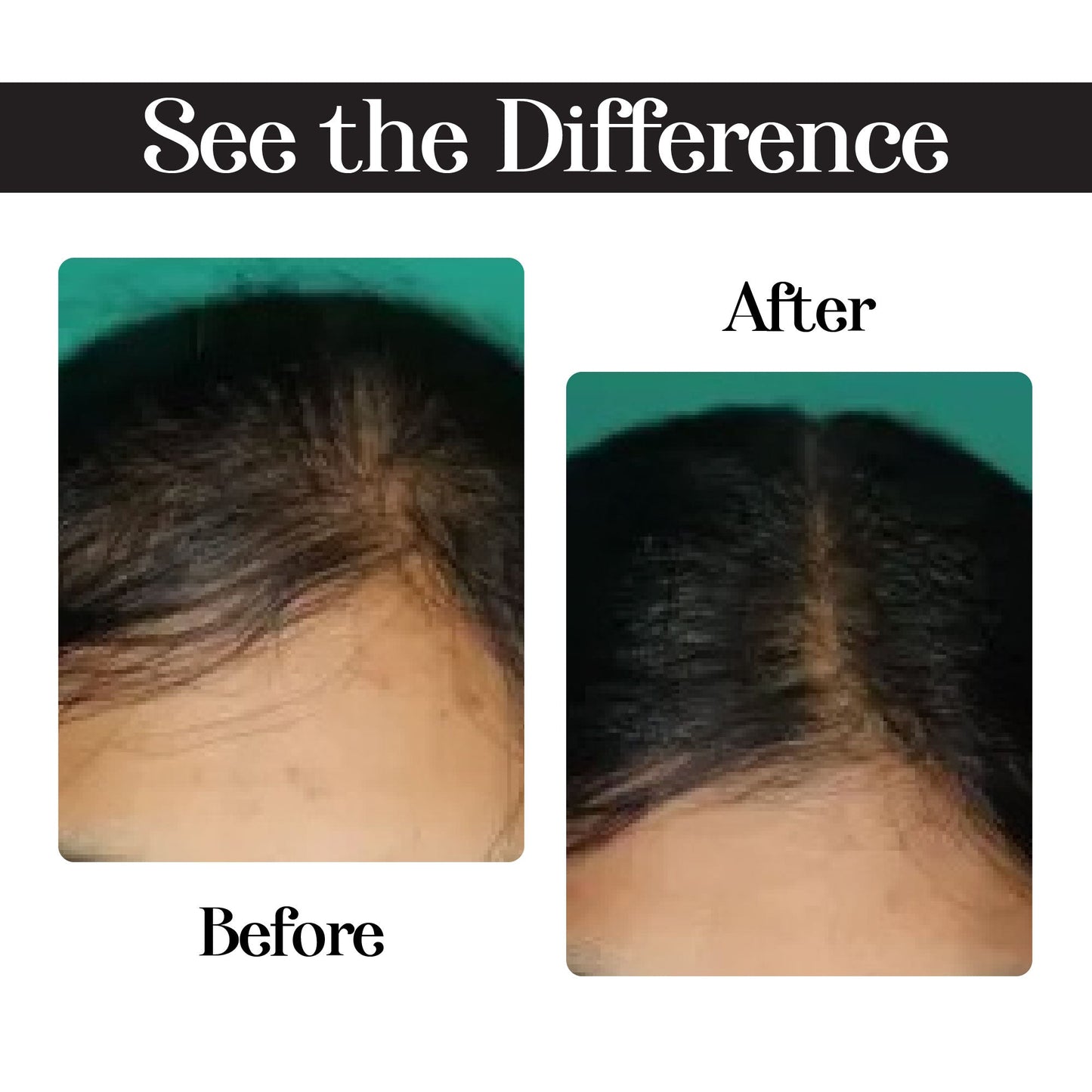 Zarywin Rosemary Hair Growth Oil - 100ml