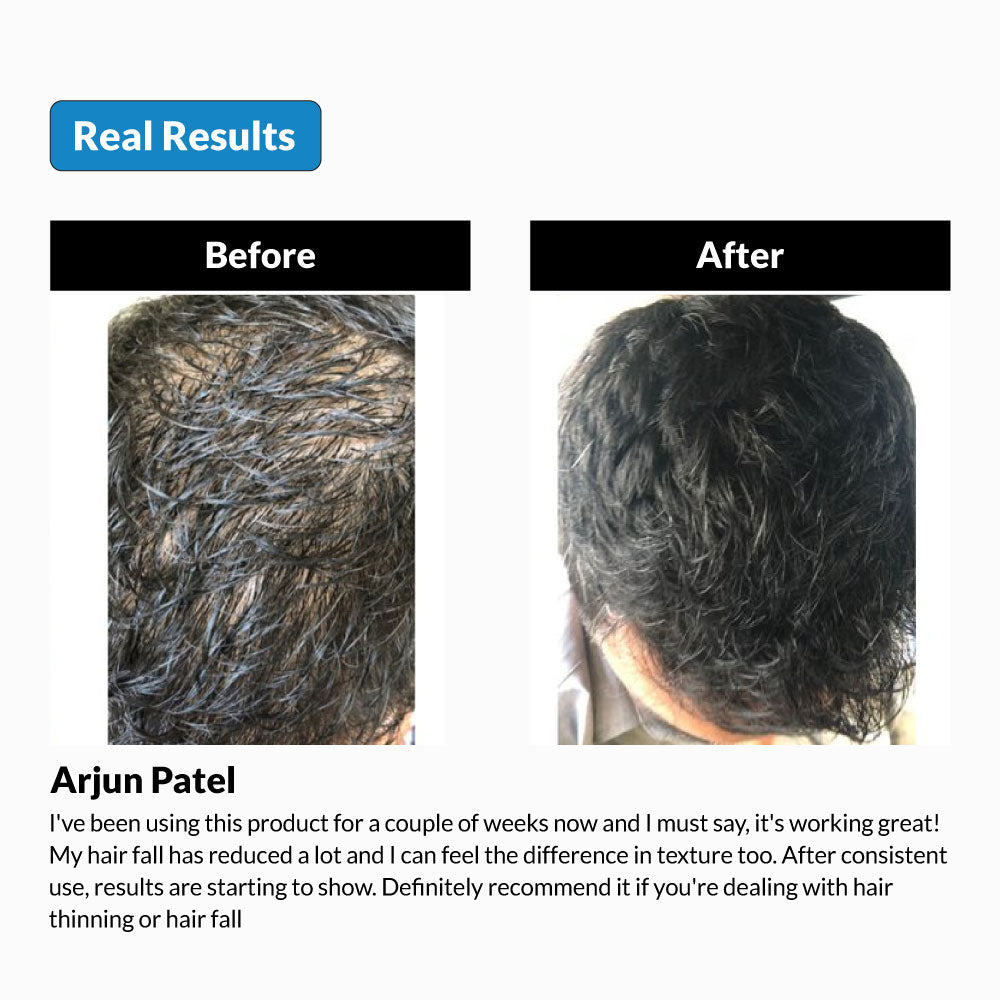 keratosome-advance-hair-serum