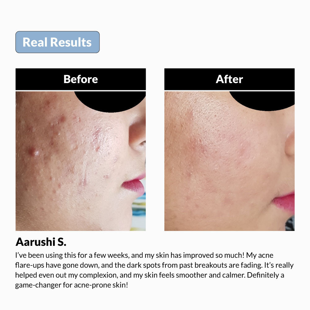 niacinamide-serum-result